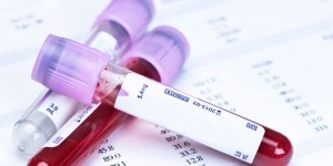 The latest in doping comes from a marine worm, is undetectable and could be in the peloton for a couple of years