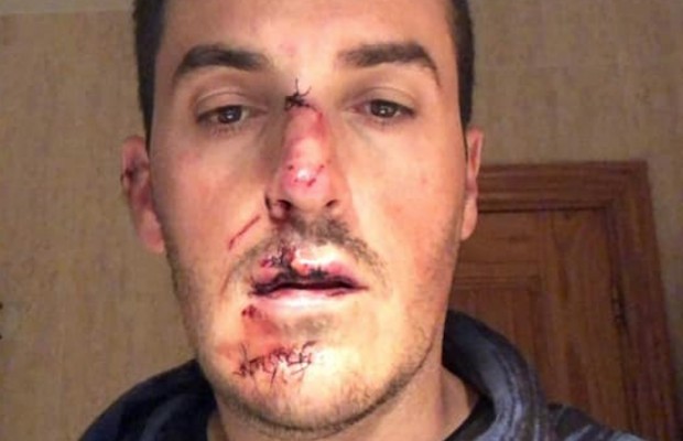 Piden ayuda para localizar el coche que atropelló a este ciclista y se dio a la fuga