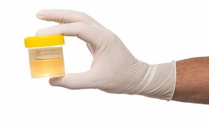 Spanish anti-doping in the spotlight of WADA: