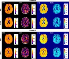 Prolonged endurance exercise causes a drastic reduction of myelin in the brain