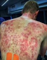 Esto es lo que sucede cuando te sorprende una granizada sobre la bici