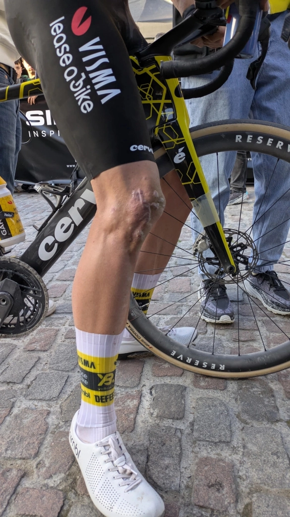 What is happening to Wout van Aert?