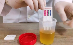 The UCI announces its anti-doping plan for the Tour de France 2025