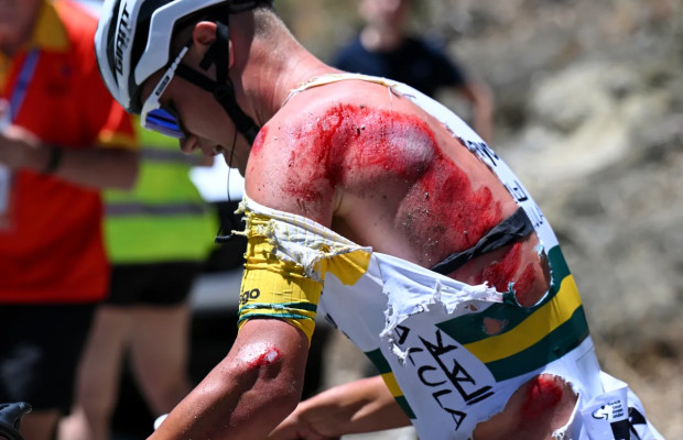 Le cyclisme sur route provoque des blessures plus graves que le VTT, selon cette nouvelle étude