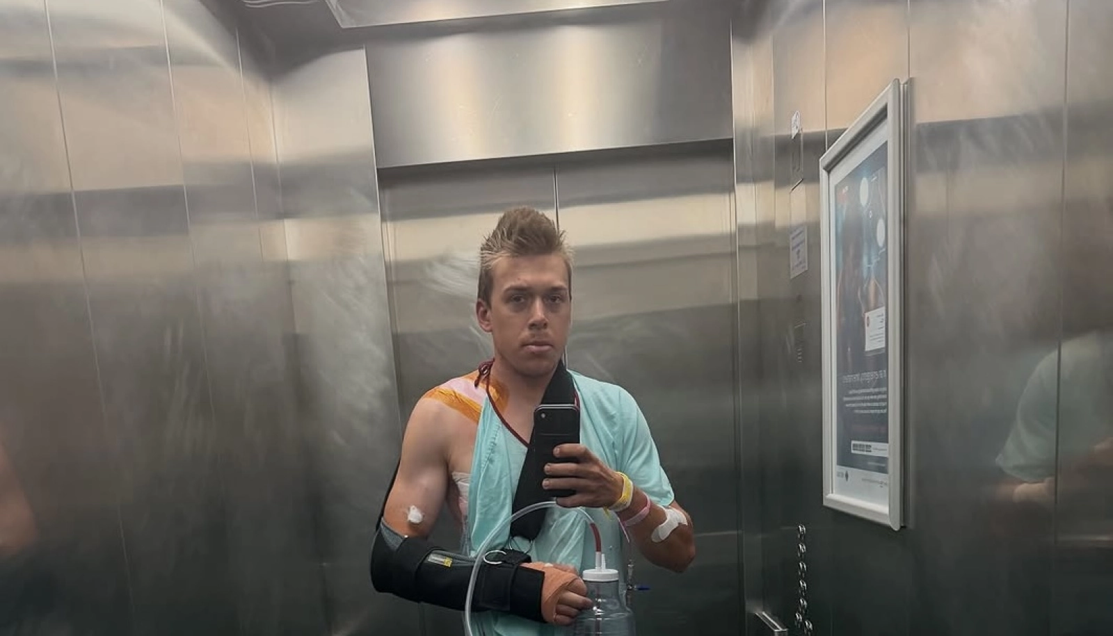 Una clavícula rota y un pulmón perforado: el duro accidente de Andri Frischknecht en la Gravel Burn