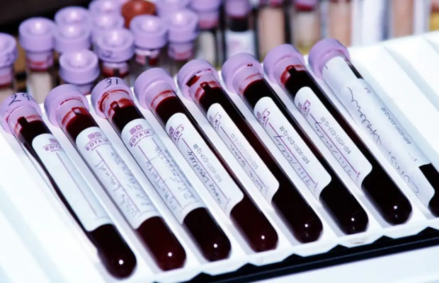 Le cas Lazkano met à l'épreuve la fiabilité du passeport biologique et la crédibilité du cyclisme