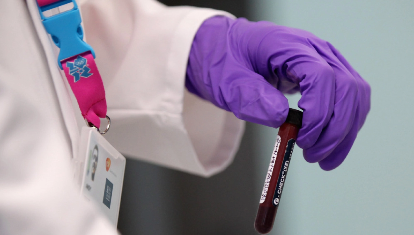 Super EPO: por qué se vuelve a hablar del dopaje con gusanos marinos