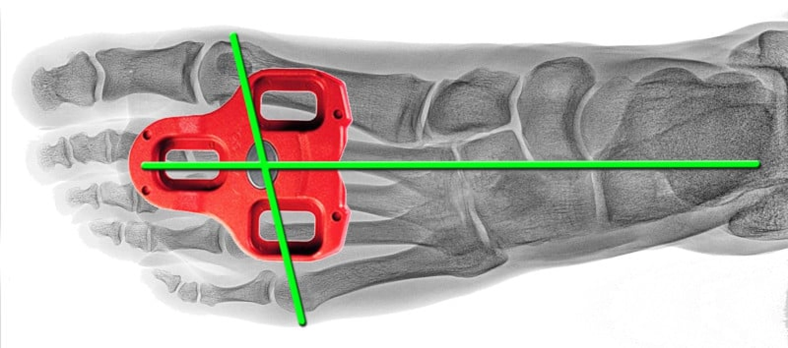 Tips for keeping your feet warm on the bike in winter