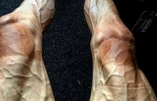 Is it a good or bad sign that your veins are so prominent? What the experts say
