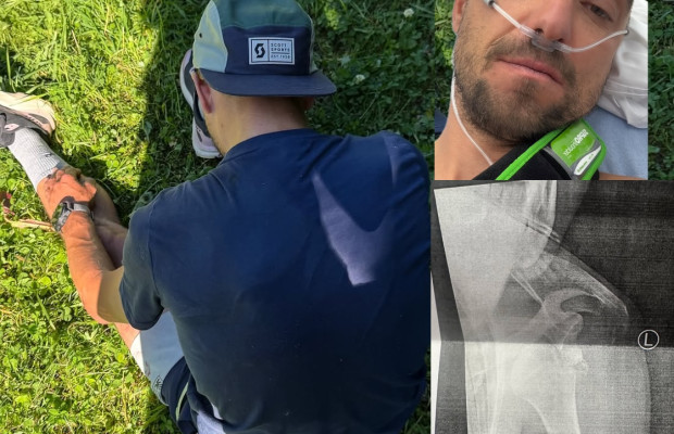 Nino Schurter sufre una de las lesiones más graves de su carrera... en patinete: fractura y luxación tras una caída