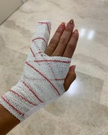 Rocío del Alba García se lesionó justo antes de los JJOO y no estará en el Europeo XCO