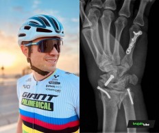 Leo Páez quebra a mão e é dúvida para defender o título na Mundial XCM