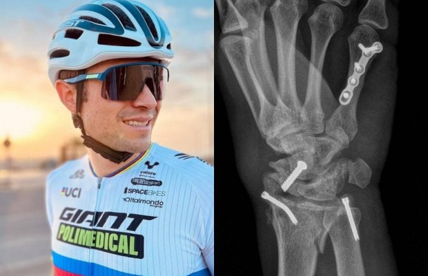 Leo Paez fractures his hand and is doubtful to defend his XCM World Championship title
