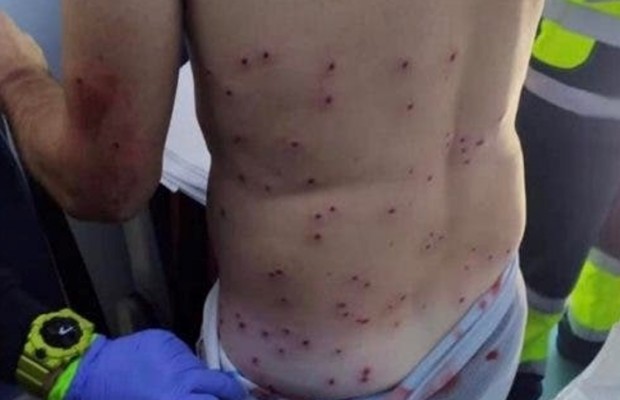 Atiraram em um ciclista de montanha em Alicante ao confundi-lo com um coelho