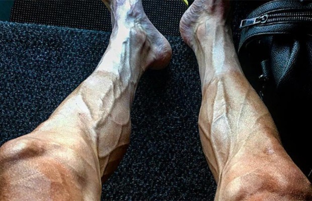 7 remédios para pernas cansadas