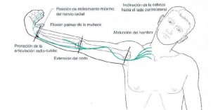 Estiramiento nervio radial