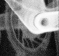 La UCI continúa su lucha contra el dopaje mecánico