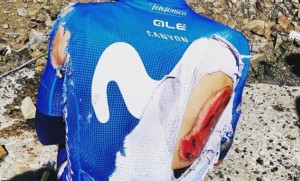 Lesiones más comunes en el ciclismo de carretera y cómo evitarlas