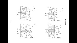 Double diamond frames could be the next trend