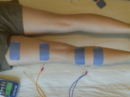 Las mejores opciones para recuperar después de cada salida