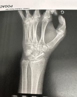 Cómo llega Pogacar al Tour de Francia 2023 ¿está para ganar?