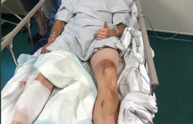 This Cyclist Suffered A Serious Injury In Paris Roubaix U 23 Because Of A Disc Rotor