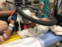 Este ciclista tuvo que ingresar en el hospital junto a la mitad de su bici