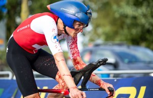 Concussion and fractures: position on time trial bike could be the cause again
