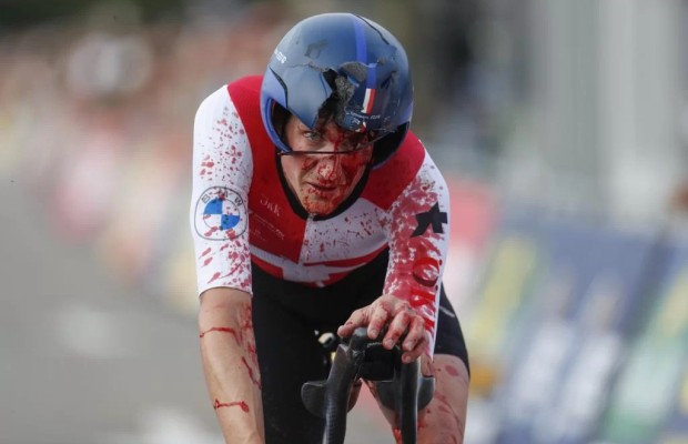 Concussion and fractures: position on time trial bike could be the cause again