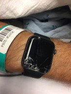 Tuvo una caída en bici y el reloj le salvó la vida