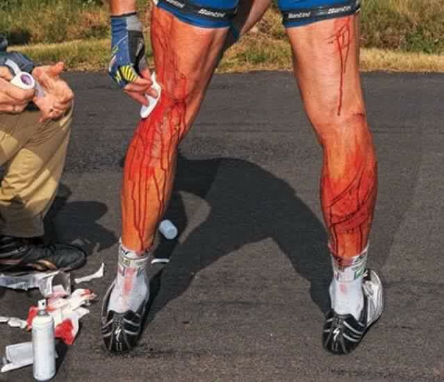 caida ciclista