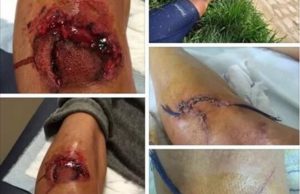 Stop de la UCI a los frenos de disco